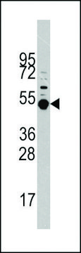 ANTI-PRAK (MAPKAPK5) (T182) antibody produced