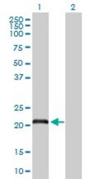 Anti-DCAKD antibody produced in rabbit