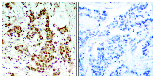 Anti-phospho-RPS6KA1 (pThr³??) antibody produced in