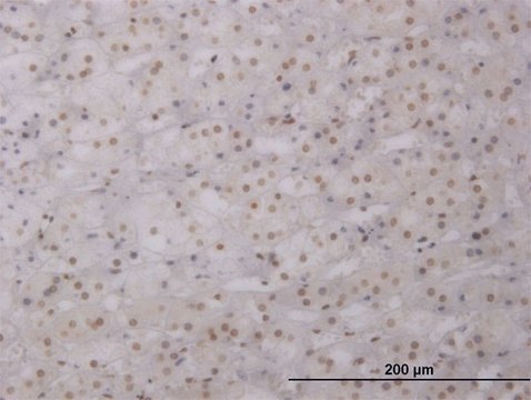 ANTI-LHX1 antibody produced in mouse