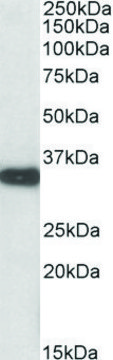 Anti-Aspa (C-terminal) antibody produced in