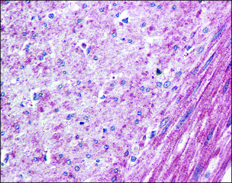 Anti-ELTD1 antibody produced in rabbit