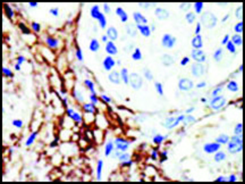 Anti-UBCE7IP4 (C-term) antibody produced in