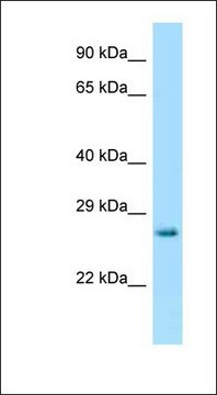 Anti-HPRT antibody produced in rabbit