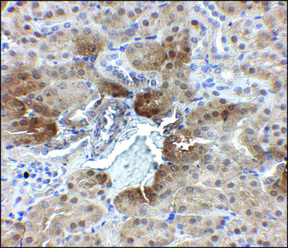 Anti-PTER antibody produced in rabbit
