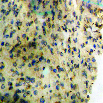 Anti-phospho-Synuclein-? (pTyr¹³³) antibody produced in