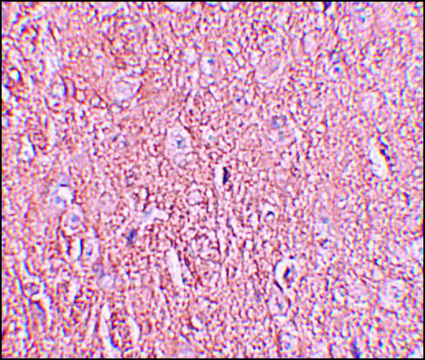 Anti-LRRTM2 antibody produced in rabbit