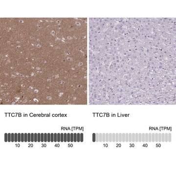Anti-TTC7B antibody produced in rabbit
