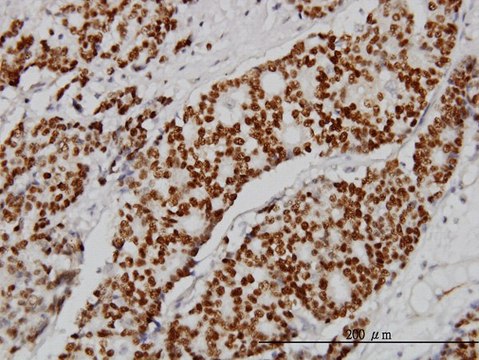 Monoclonal Anti-PGR antibody produced in