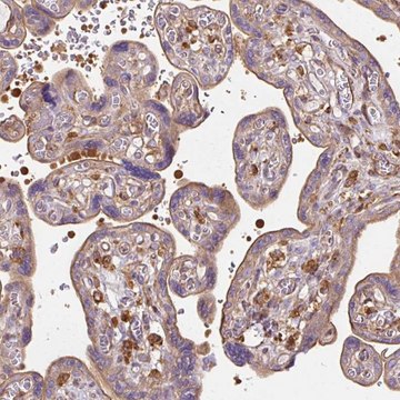 Anti-TBC1D2B antibody produced in rabbit