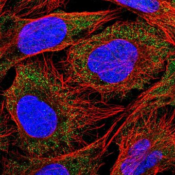 Anti-SLC18B1 antibody produced in rabbit