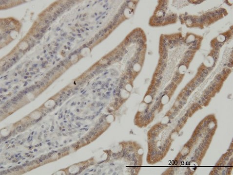 Monoclonal Anti-CSNK1G1 antibody produced in