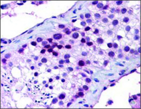 Anti-HOXA5 antibody produced in rabbit