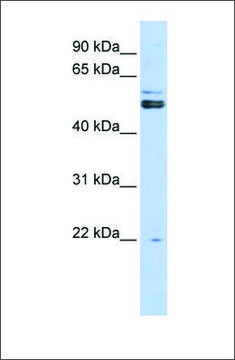 Anti-PRMT2 antibody produced in rabbit