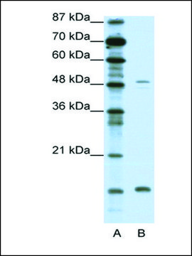 Anti-FBN1 antibody produced in rabbit