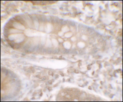 Anti-KREMEN1 antibody produced in rabbit