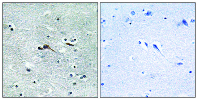 Anti-CYTL1 antibody produced in rabbit