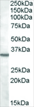 Anti-Bradykinin Receptor B1 antibody produced