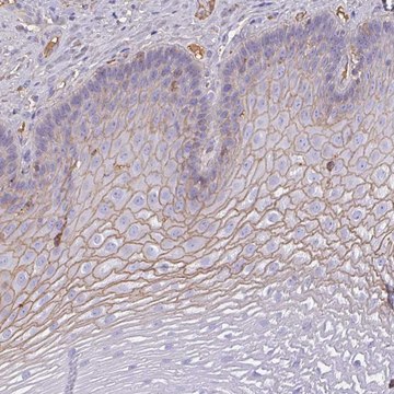 Anti-SMYD5 antibody produced in rabbit