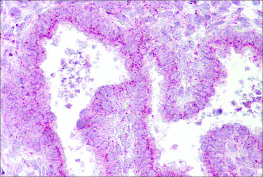 Anti-GOLGB1 antibody produced in rabbit