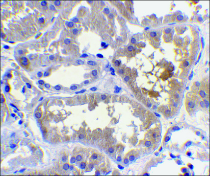 Anti-RAIDD antibody produced in rabbit