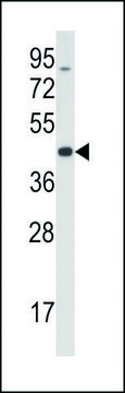 ANTI-MOUSE TRIB3 (C-TERM) antibody produced