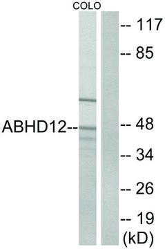 Anti-ABHD12 antibody produced in rabbit