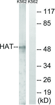 Anti-HAT antibody produced in rabbit
