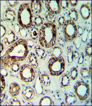 ANTI-CCR1 (N-TERM) antibody produced in