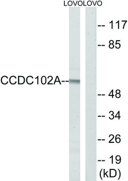 Anti-CCDC102A antibody produced in rabbit