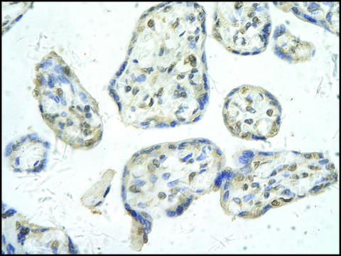 Anti-PPARD antibody produced in rabbit