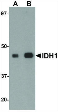 Anti-IDH1 antibody produced in rabbit