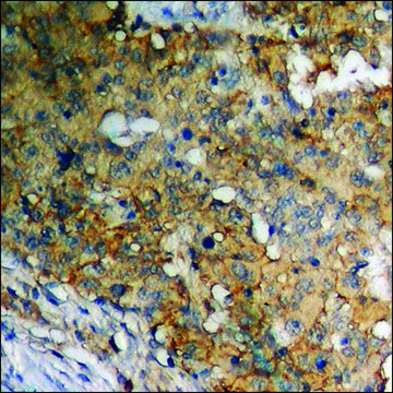 Anti-phospho-Adrenergic Receptor B2 (pSer³??+Ser³??) antibody