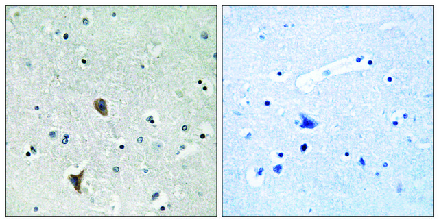 Anti-OXR1 antibody produced in rabbit