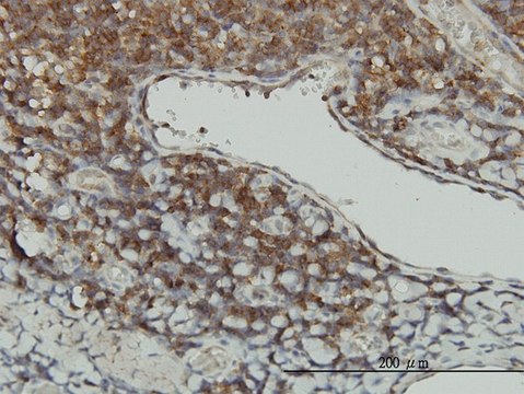 Monoclonal Anti-STK16 antibody produced in
