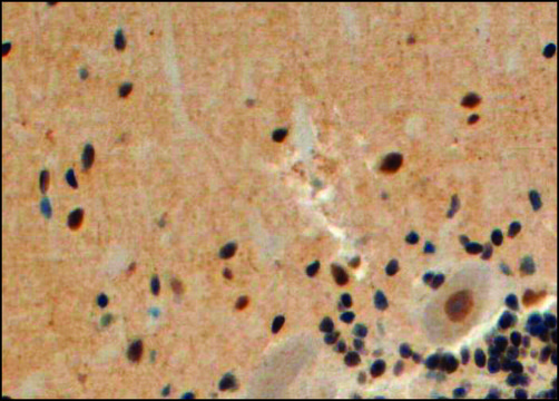 Anti-Arrestin ?2 antibody produced in