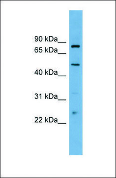 Anti-TFEB antibody produced in rabbit