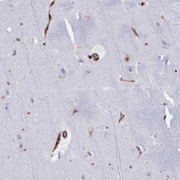 Anti-EML1 antibody produced in rabbit