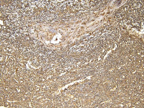 Anti-FTL antibody produced in goat