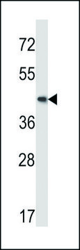 ANTI-MOUSE MAP2K5 (C-TERM) antibody produced