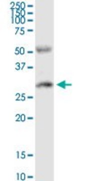 Anti-PPP2R3B antibody produced in rabbit
