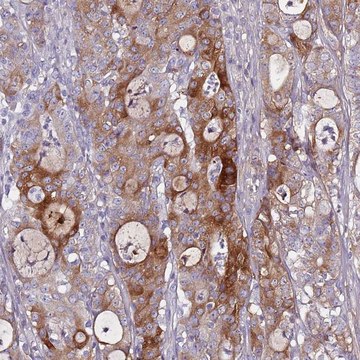 Anti-TNFRSF6B antibody produced in rabbit