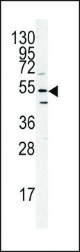 ANTI-ATG14(N-TERMINAL) antibody produced in rabbit