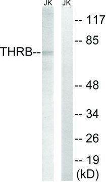 Anti-THRB (AP2, Cleaved-Arg³²?) antibody produced