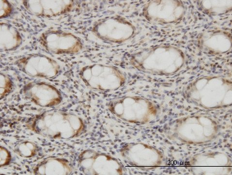 Monoclonal Anti-CSE1L, (C-terminal) antibody produced