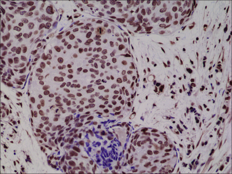 Anti-p38 MAPK Phospho (pT180/pY182) antibody,