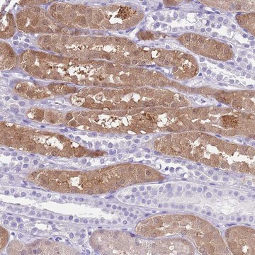 Anti-TMEM185A antibody produced in rabbit