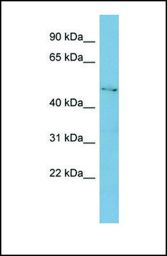 Anti-C1GALT1 antibody produced in rabbit
