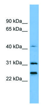 Anti-HIST1H1E (N-terminal) antibody produced in