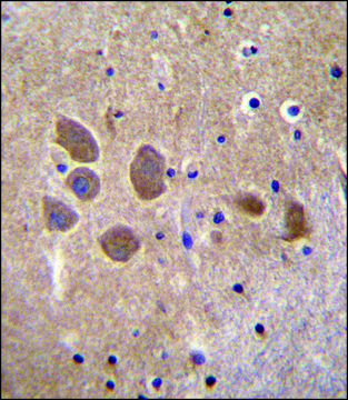 ANTI-AP1M1 (CENTER) antibody produced in
